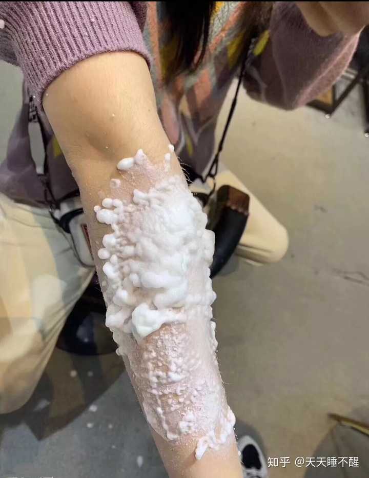 脱毛膏脱完毛后会越长越多吗 知乎