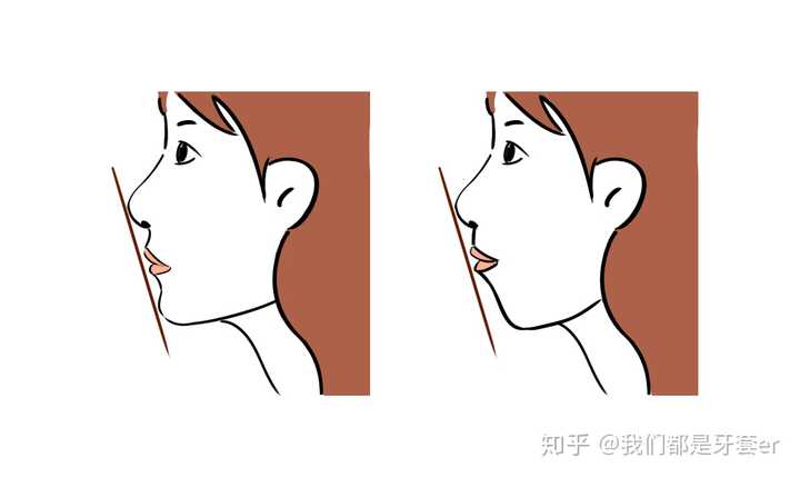 呼吸可以分为口呼吸和鼻呼吸两种,正常呼吸时空气由鼻腔进入肺,而当