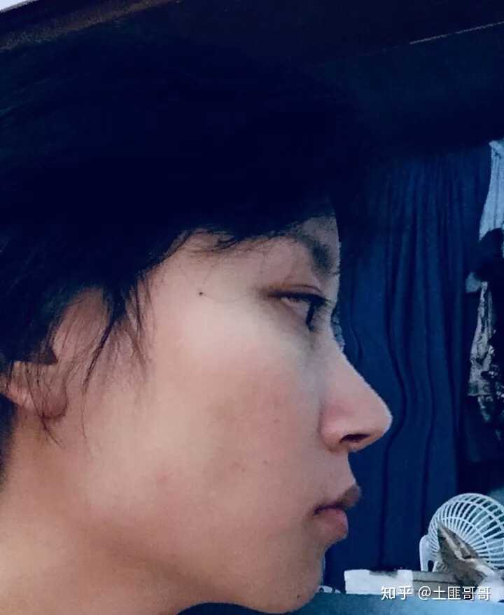 请问小哥哥小姐姐我这么丑的侧颜还有救呢?