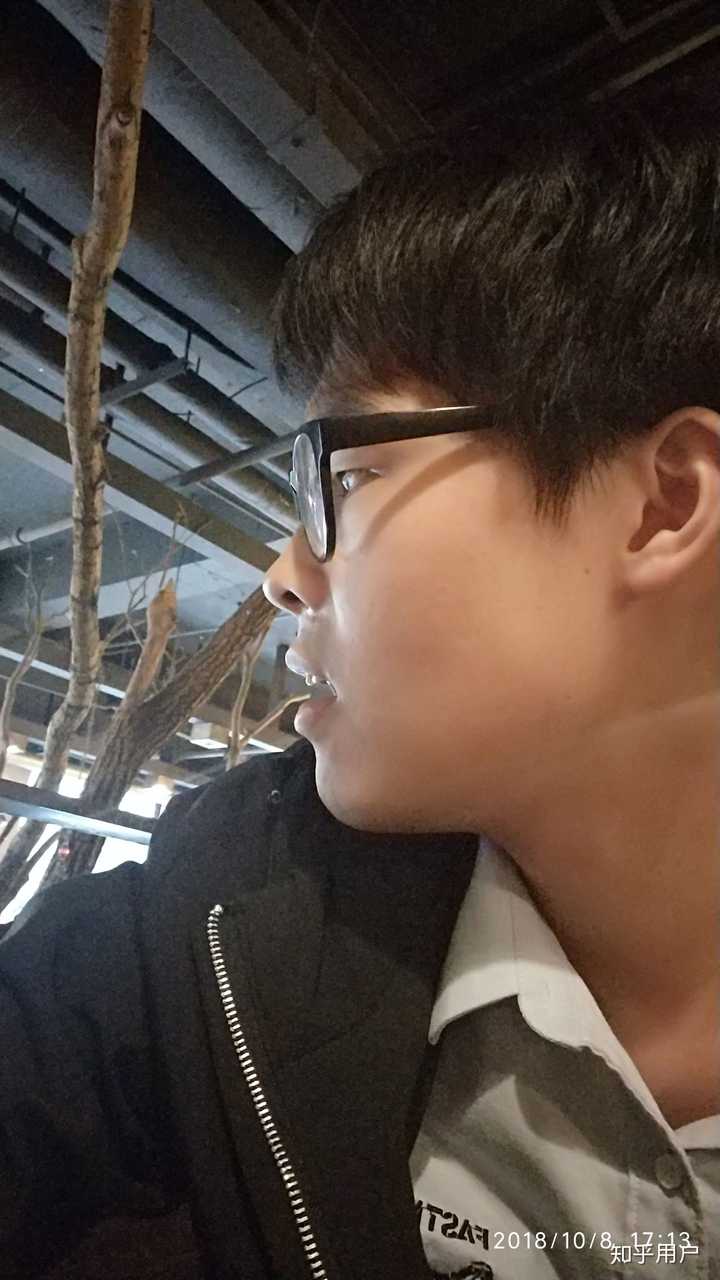 正脸好看但侧脸丑到爆是种怎样的体验?