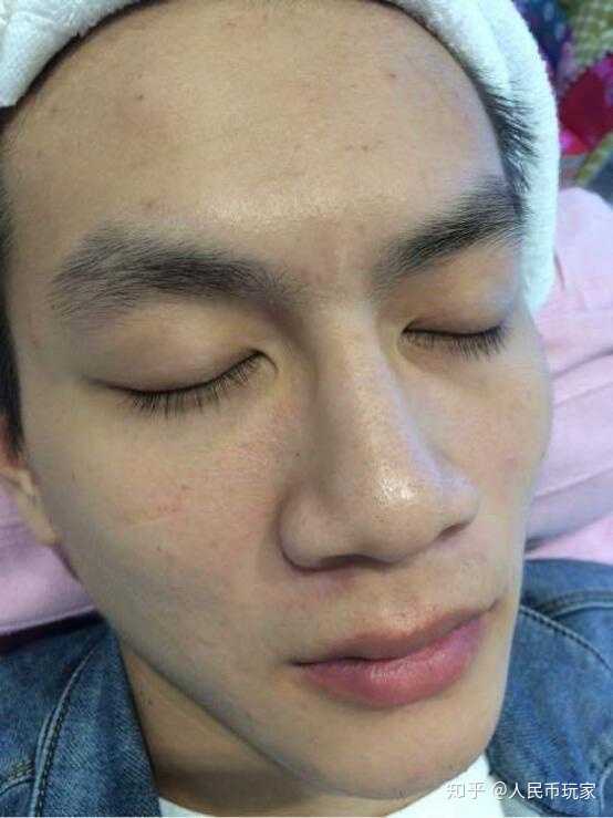 男士去黑头效果好的的护肤产品什么比较好 知乎 男士去黑头效果好的的护肤产品什么比较好 知乎