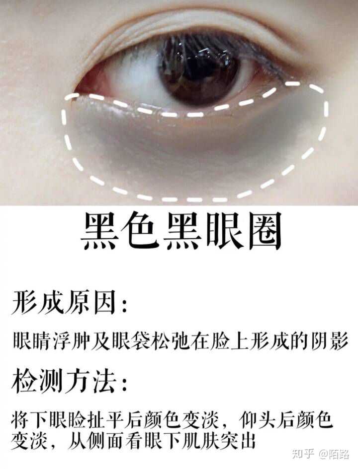 如何分辨并去除眼袋和黑眼圈 知乎