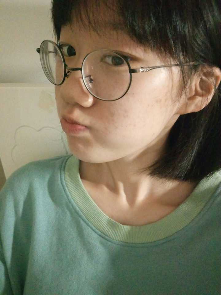 女生蒜头鼻到底好不好啊?鼻梁低鼻子大没活路吗