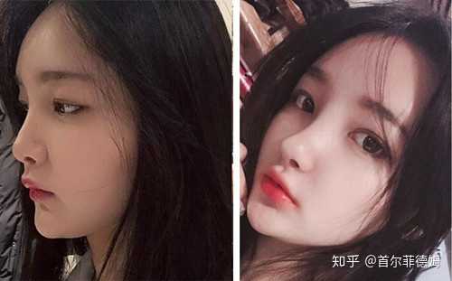 韩国哪家医院做鼻子整形比较好 国内的医生的 不耍大牌不吭的 知乎 韩国哪家医院做鼻子整形比较好 国内的医生的 不耍大牌不吭的 知乎