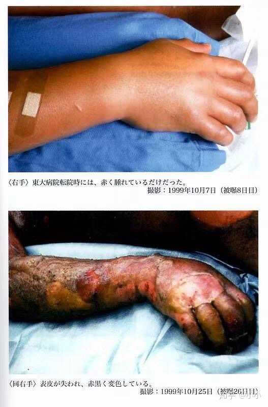 如果一个人全身的dna全部瞬间断裂或者失活会怎么样?