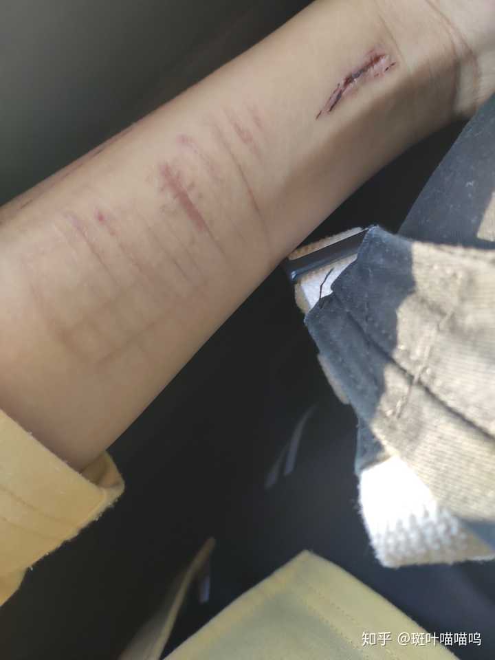 还有83天. (自残什么的还是不要了,真的不好) 比如说我现在的