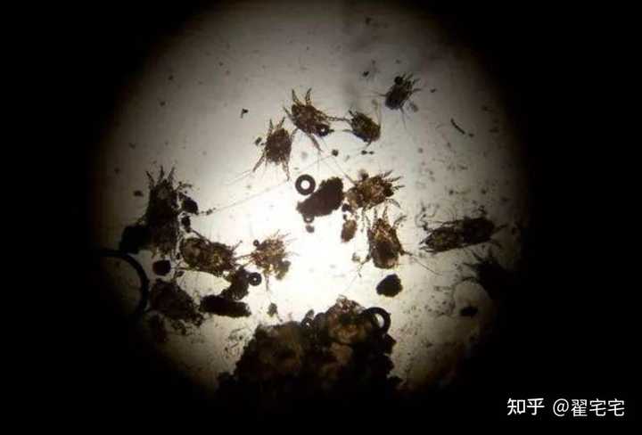 什么牌子的除螨喷雾或者除螨包好用啊 想买一些给弟弟用 安全一点比较好 知乎