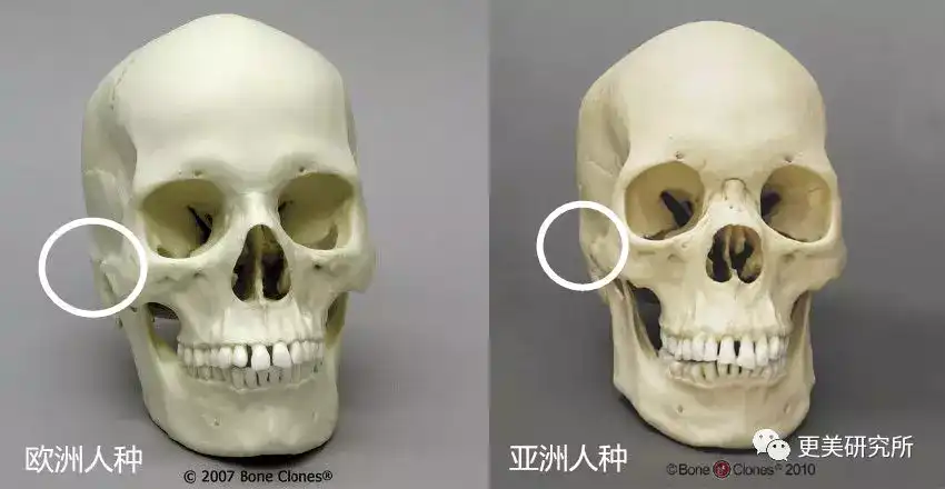 骨骼的特征之一) 像娘娘章子怡这种轻度颧弓外凸对脸型的影响并不太大