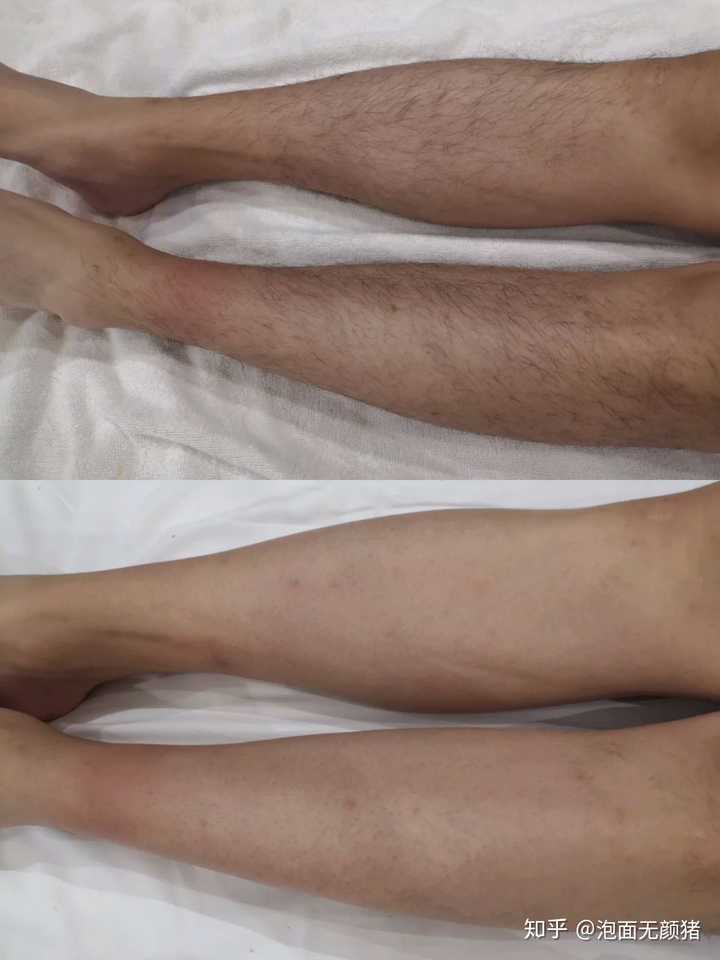 男人脱毛用什么好 知乎 男人脱毛用什么好 知乎