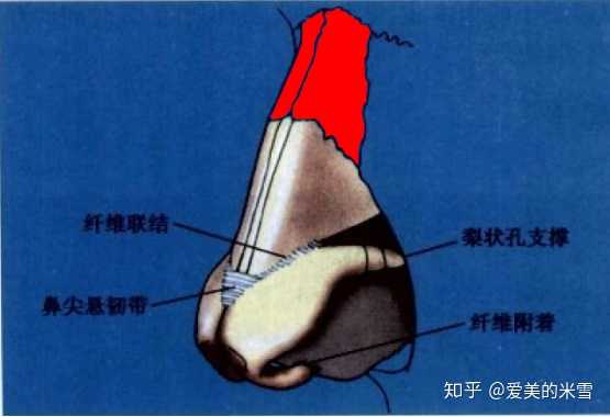 有鼻骨宽的做鼻骨内推手术的吗?