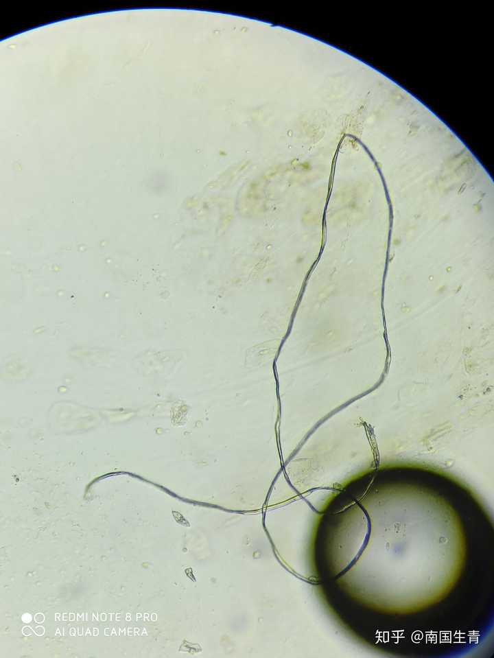 常见寄生虫虫卵镜下图 猫寄生虫卵图片显微镜 前后盘吸虫卵图片