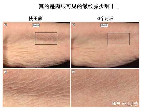 长期用a醇对皮肤真的好吗 知乎 长期用a醇对皮肤真的好吗 知乎