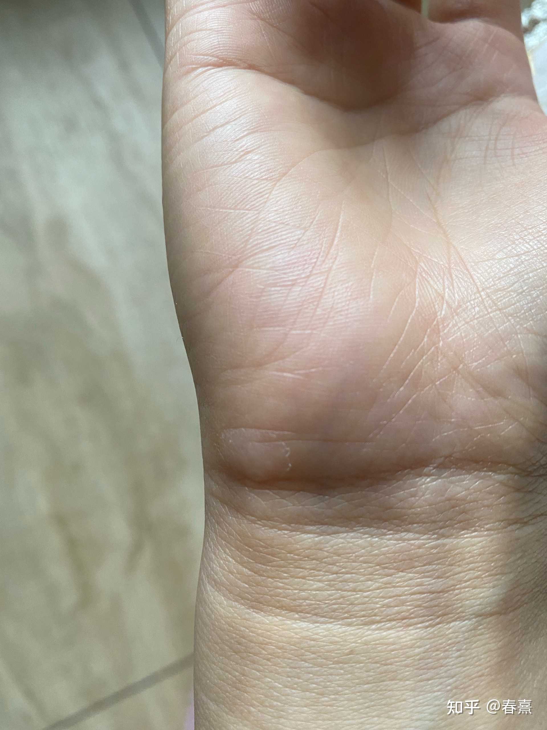 春熹 的想法: 这只手上有鼠标茧 - 知乎
