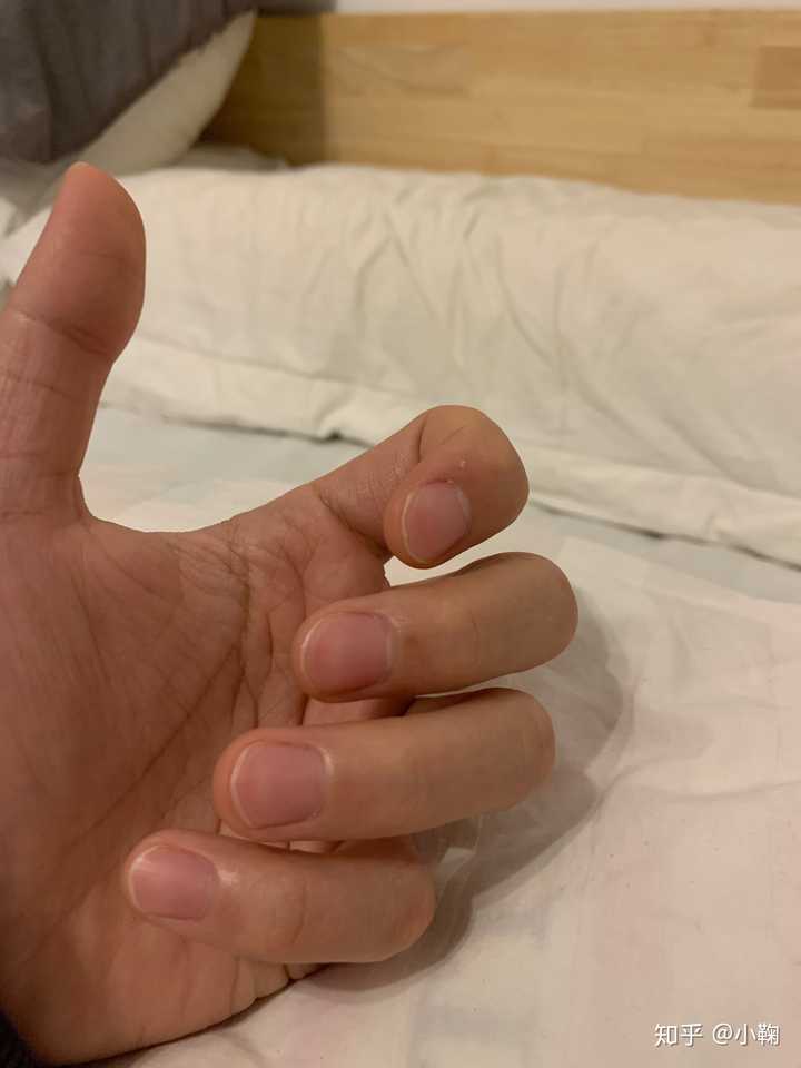 打算学一下吉他,就想问:指甲要剪多短?