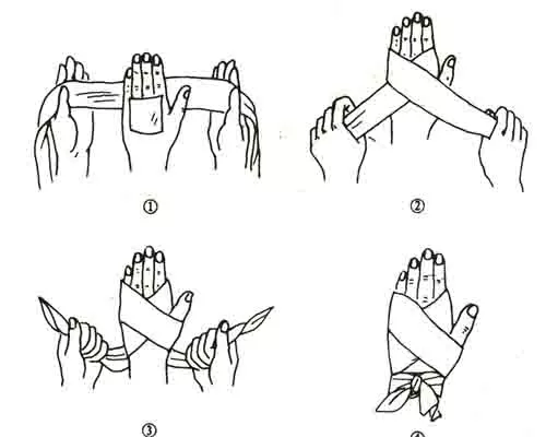 67登录加入知乎医学健康常识伤口处理什么情况下受伤会留疤?流血?