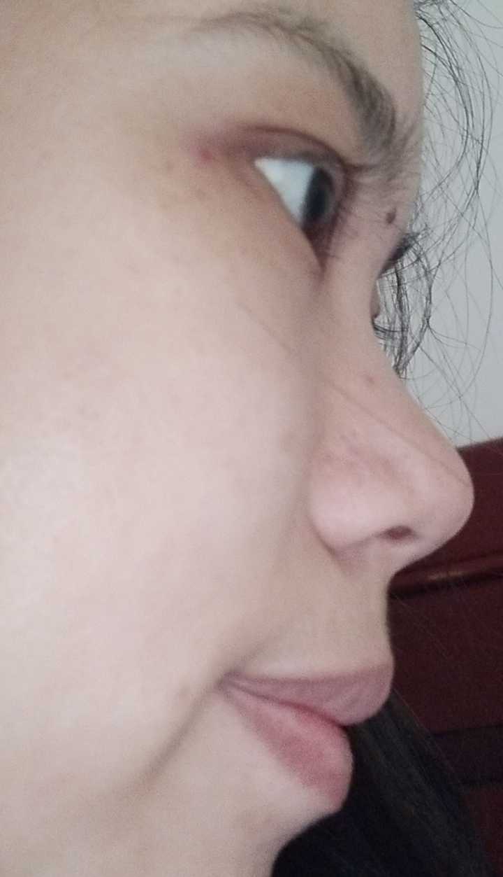 女生蒜头鼻到底好不好啊?鼻梁低鼻子大没活路吗