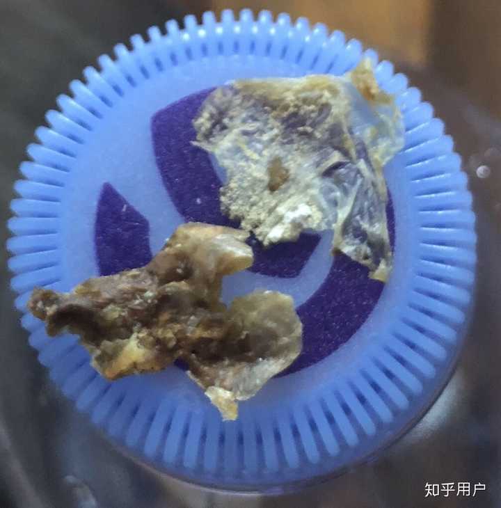 铁耳屎是怎么形成的图片