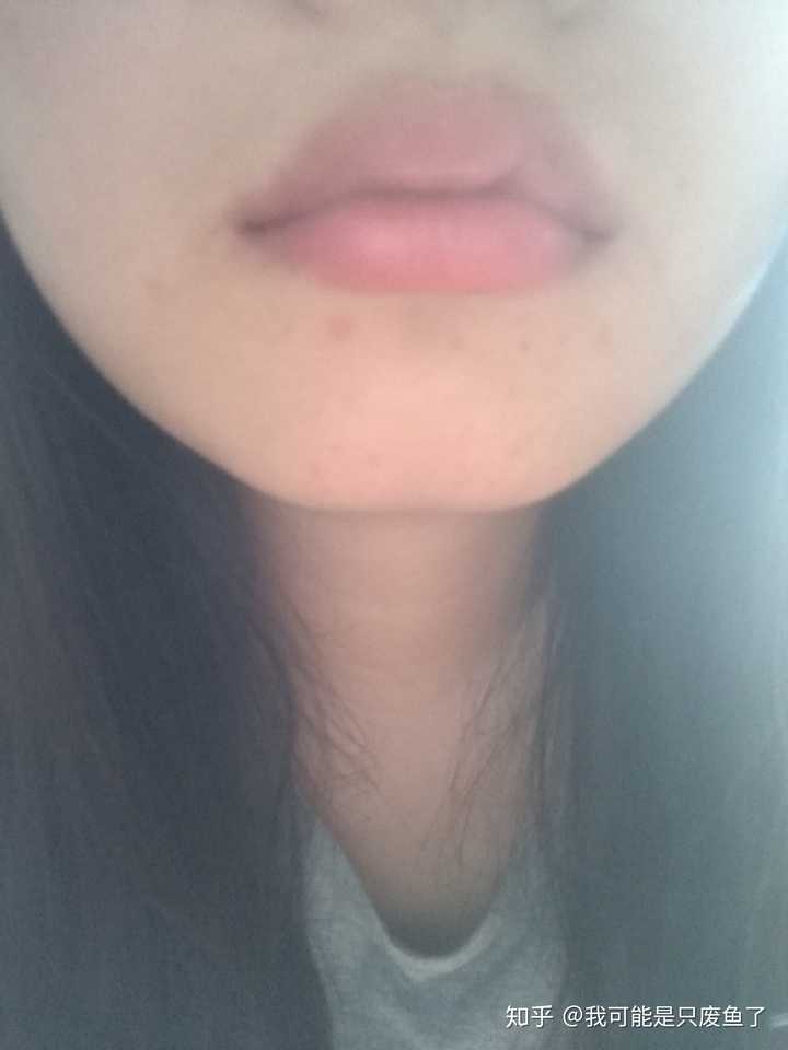 自信一点吧,像我嘴唇厚唇色深,脸肥,嘴巴周围都是痘
