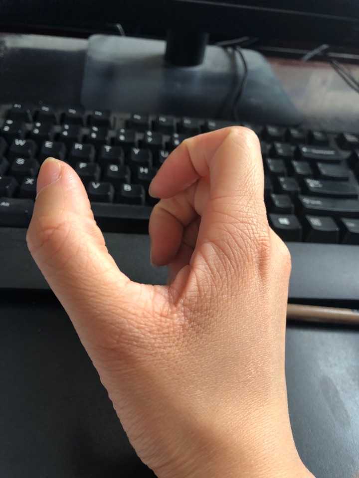 年纪轻轻23岁手上皮肤就很干有很多皱纹 像老年人干瘪的手 怎么办呀 知乎 年纪轻轻23岁手上皮肤就很干有很多皱纹 像老年人干瘪的手 怎么办呀 知乎