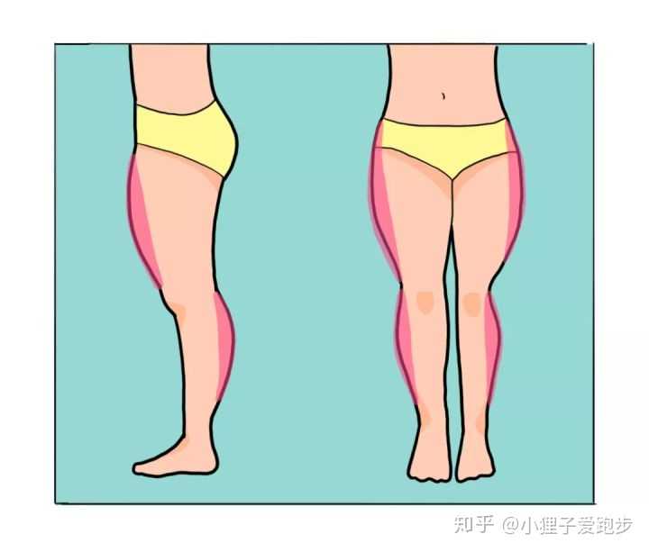 类型一:大腿外侧突出型