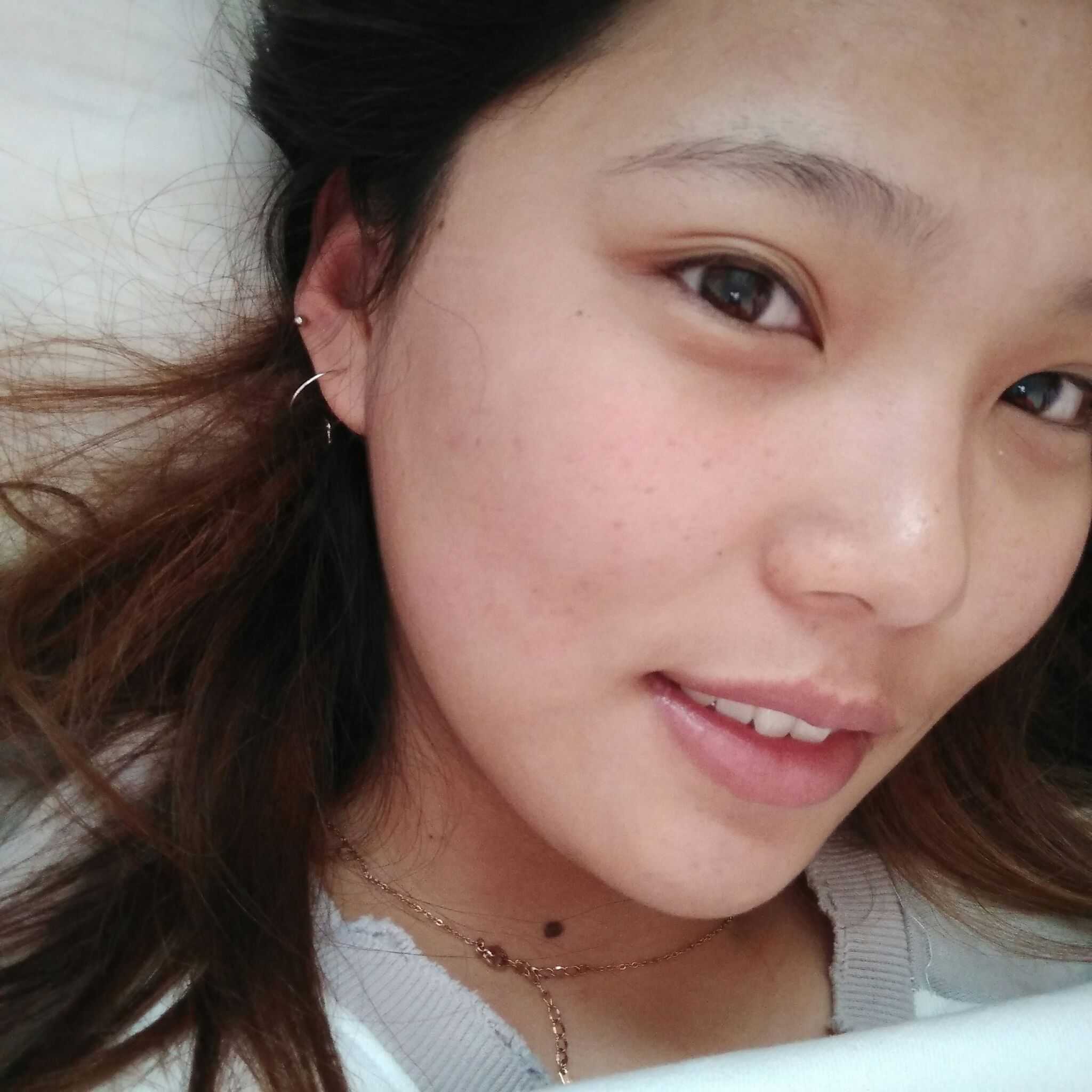 我用了半年时间终于去掉了闭合粉刺只想和大家分享一下,素颜的照片不