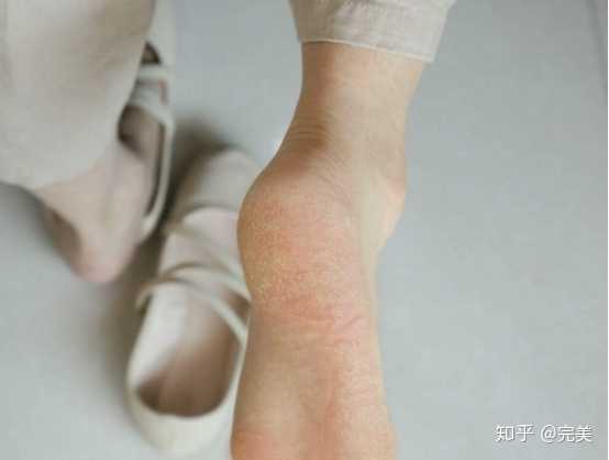 脚部该如何保养 比如去角质等问题 知乎 脚部该如何保养 比如去角质等问题 知乎