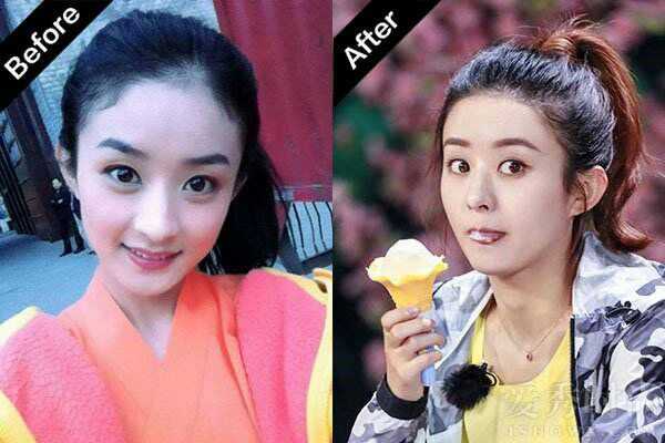 爱吃肉的小猪猪 目前知道的只有植发or抹生发精油or做个半永久发际线