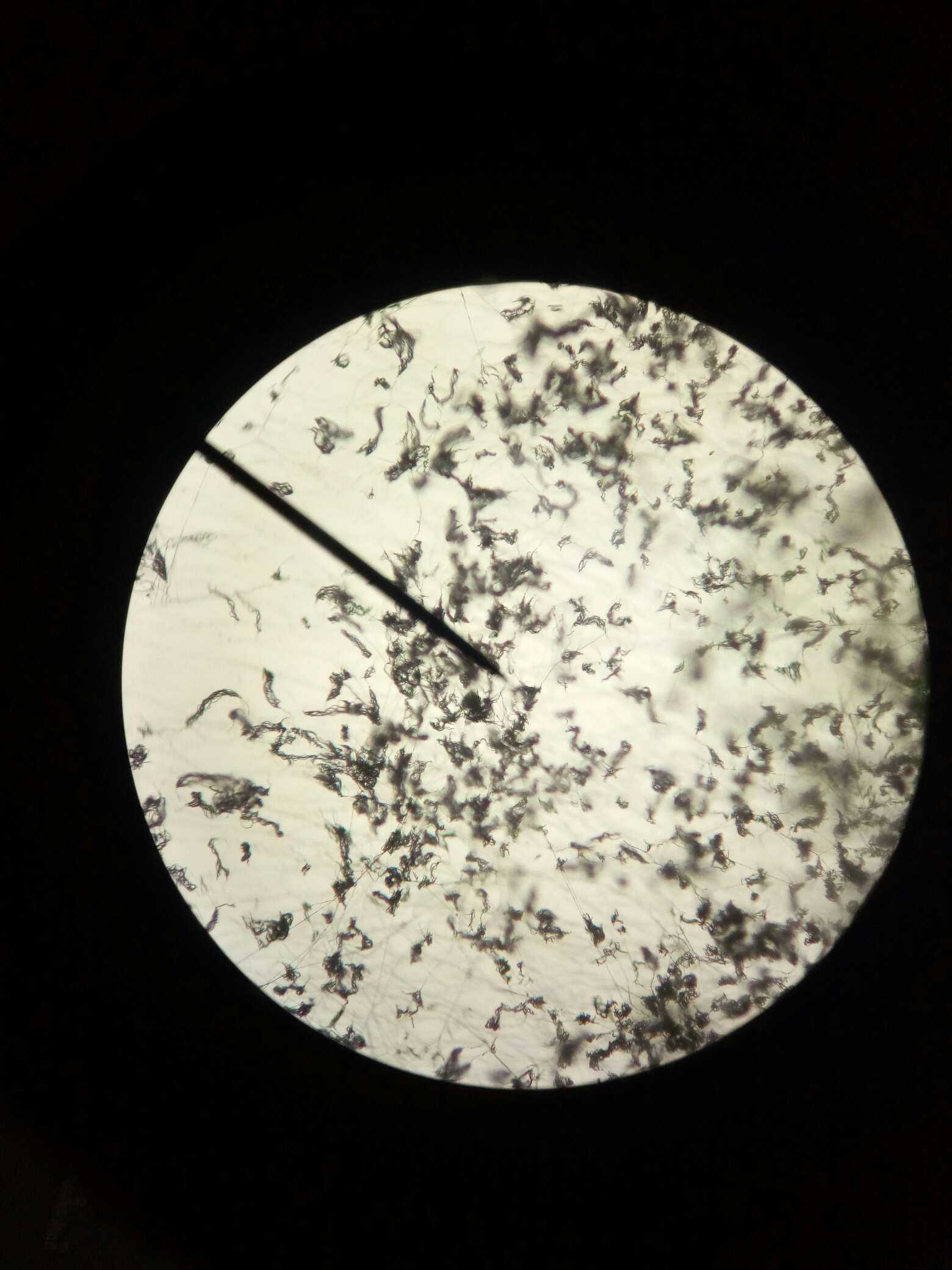放线菌显微镜图片40倍图片