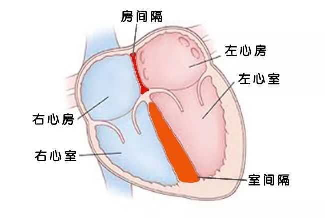 先心病房间隔缺损多大必须手术?