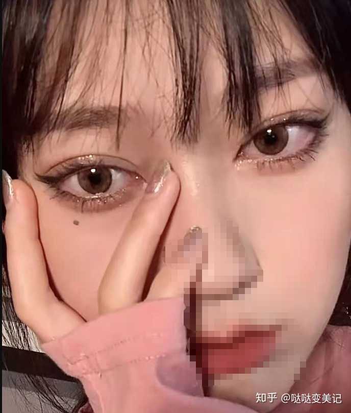 贵州哪里做双眼皮最好 知乎