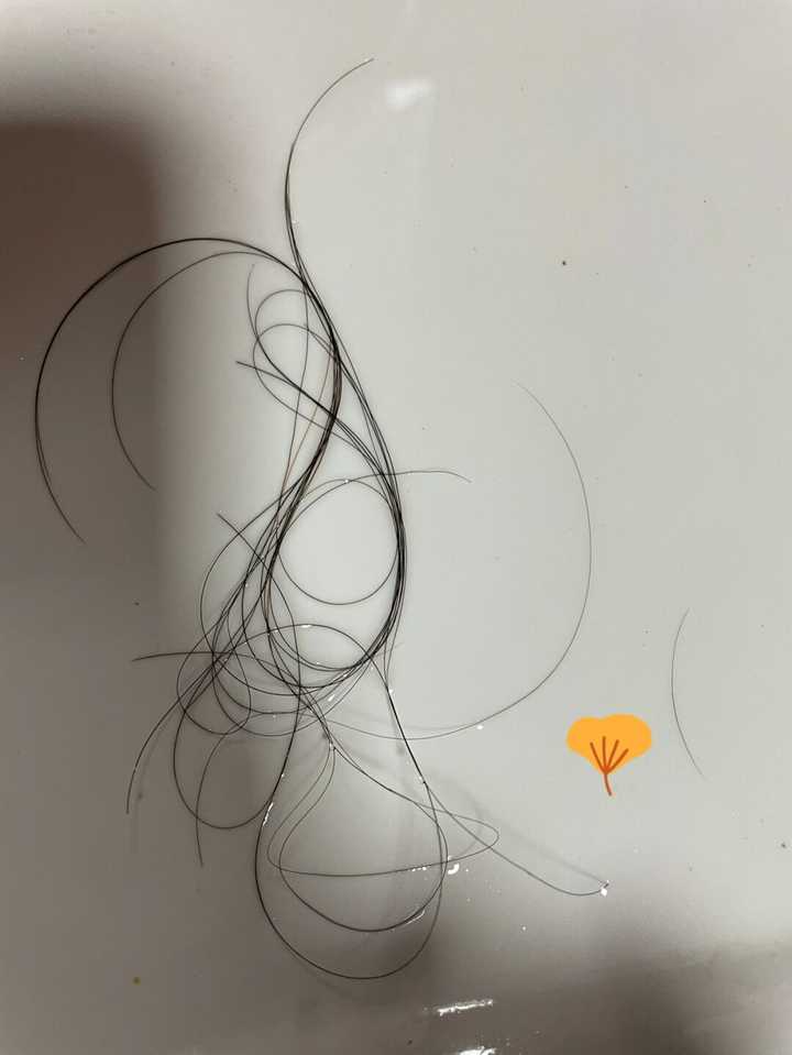 掉头发很厉害，怎样可以增长发量？