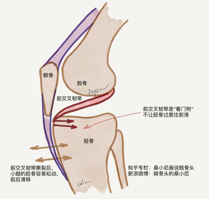 膝关节侧面图:前交叉韧带从股骨的后侧穿行到胫骨的前侧,防止小腿的