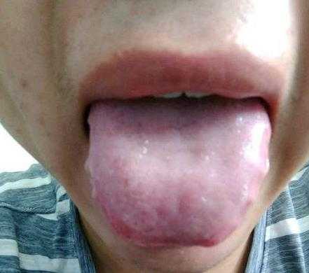 艾草肚脐贴真的可以祛湿减肥吗?附案例-守护佛网