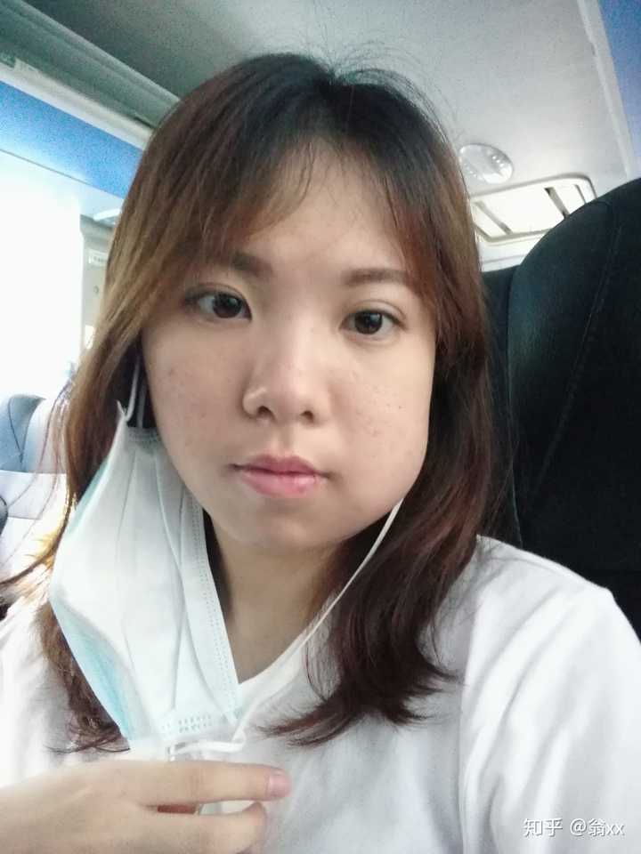 拔完智齿脸为什么会肿 知乎