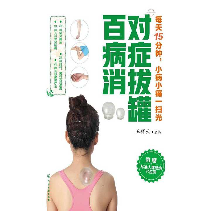 拔罐为什么不能每天连着拔罐 v2-fe39c640ae2ccd47374aaca467538ea7_720w.jpg?source=54b3c3a5