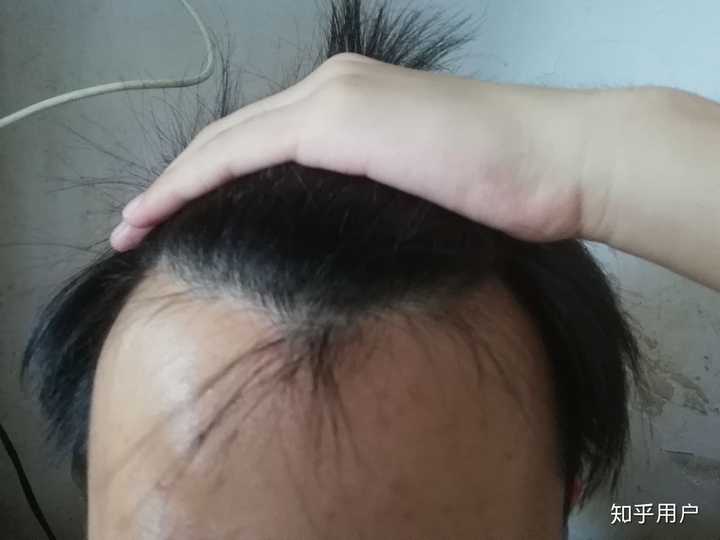 我才17岁,救救这个可怜的孩子吧