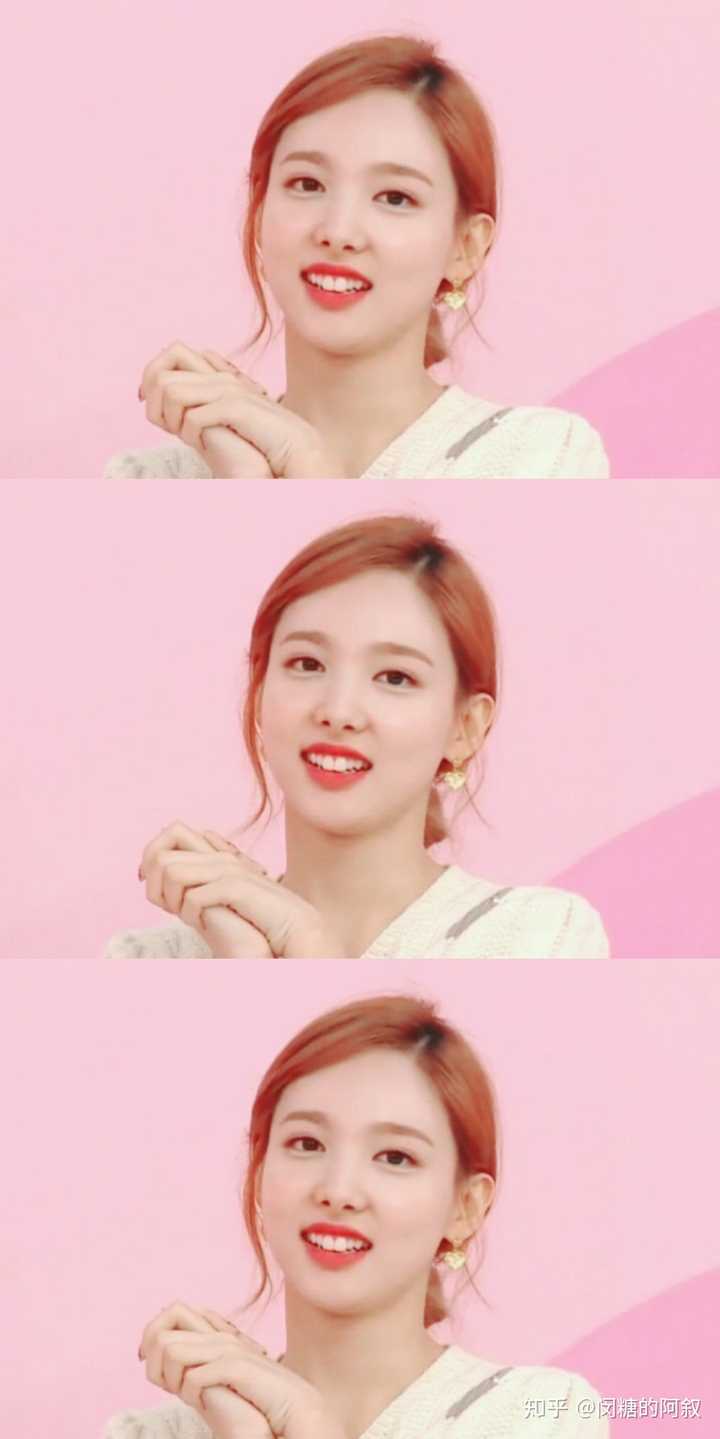 有哪些有兔子牙的艺人/明星/演员?