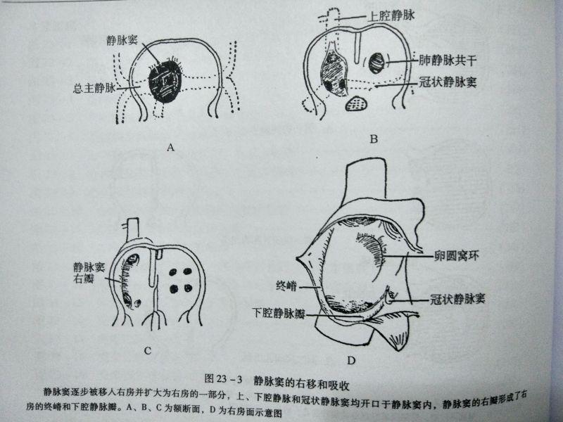 教你读心脏彩超之房间隔缺损 - 知乎