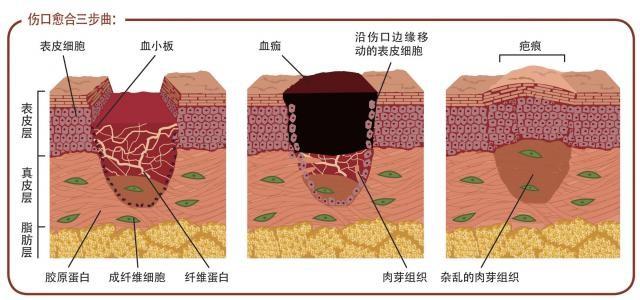 什么是「发物」，在哪些情况下不能吃，为什么？ - 知乎