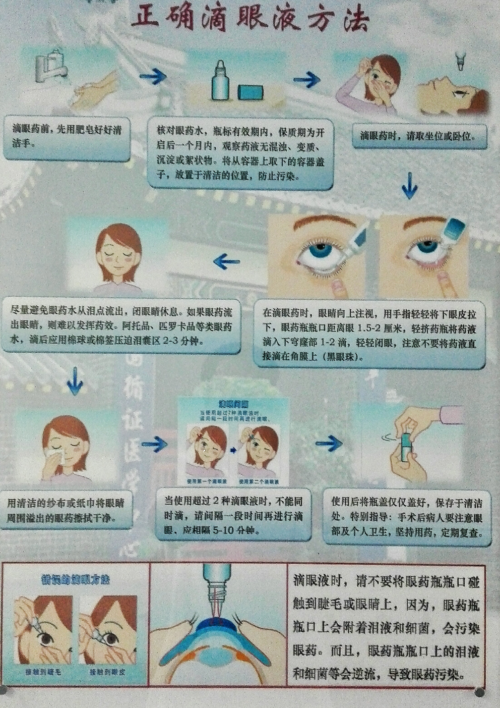 最正确的滴眼药水操作步骤是怎样的