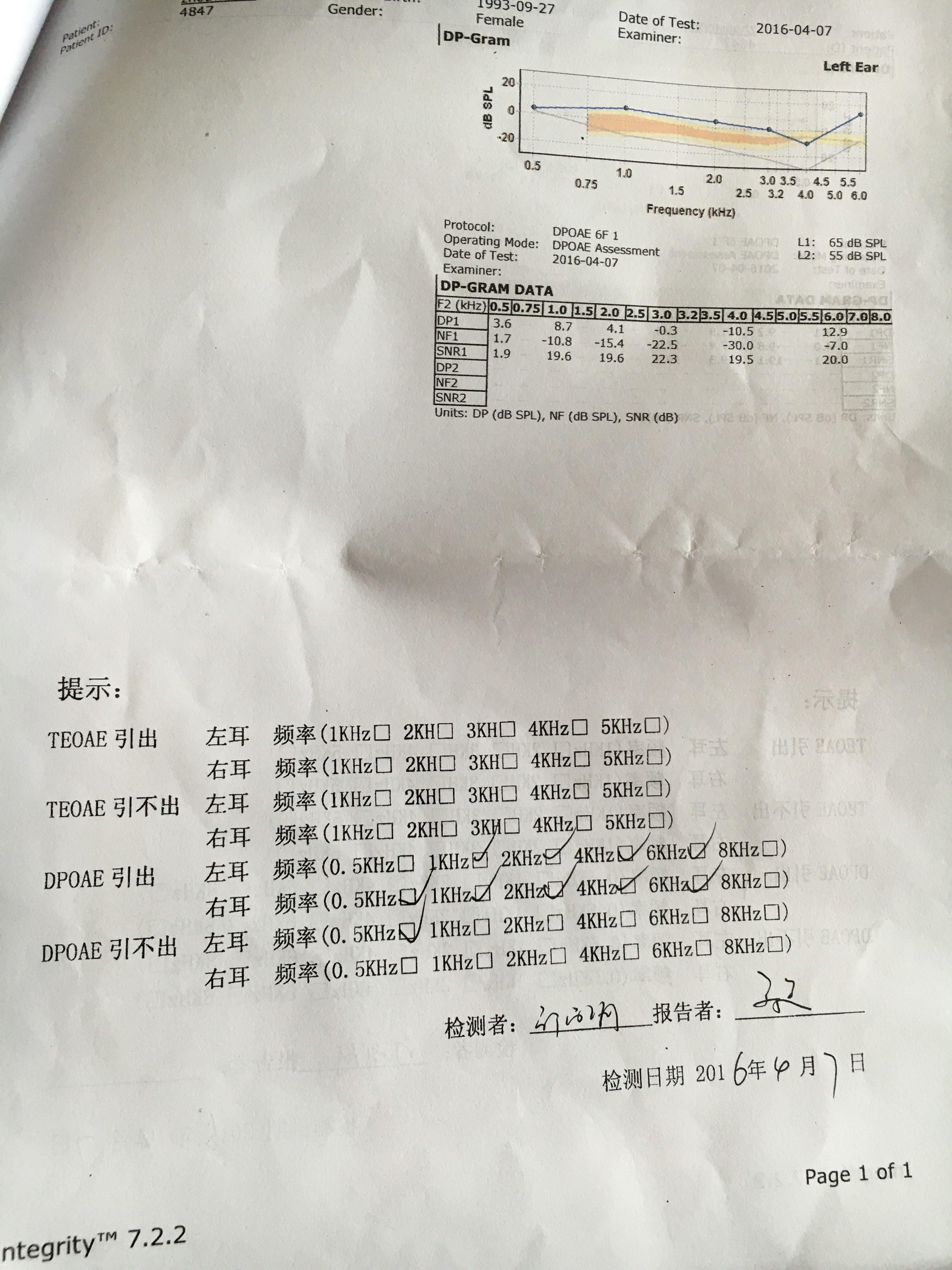 请问有耳鼻喉专家能够解释一下我这个耳声发射检测报告吗非常感激