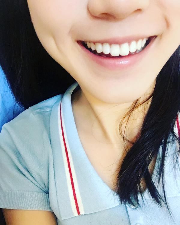 牙齿整齐笑起来很好看是一种什么体验?
