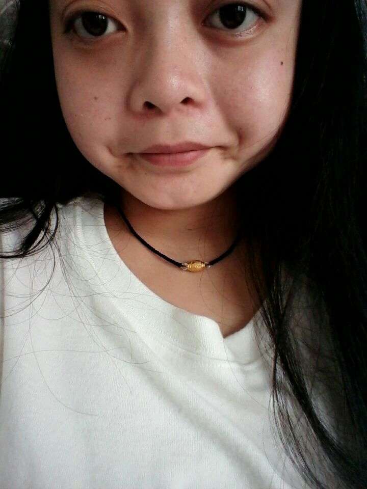 旁边的婴儿肥怎么瘦脸啊?