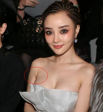 『健康贴士』女性副乳如何改善？