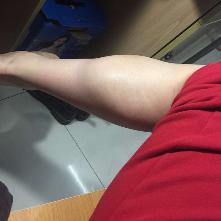 小腿肌肉发达的女生如何塑型?