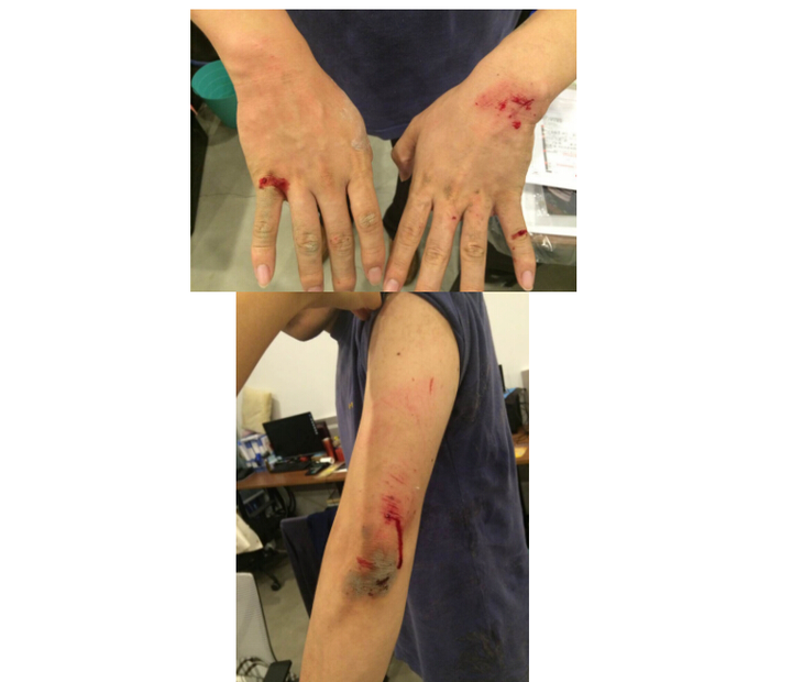 说说一些公司高管被打?谁知道里面的内幕吗?