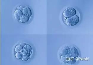 成都供卵试管哪家好（试管婴儿移植的流程步骤怎么样的？）