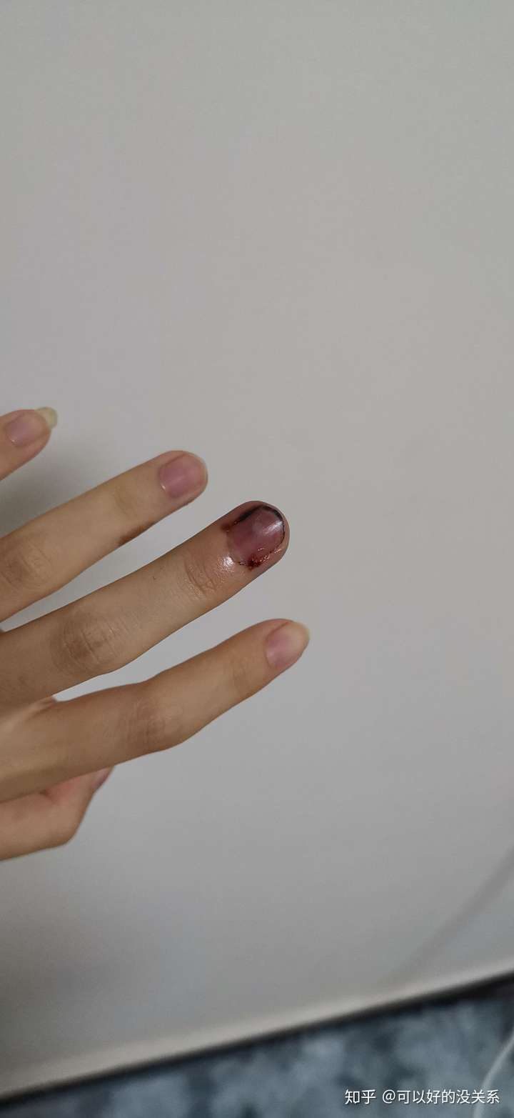 手指被门夹到飙泪是种怎样的体验?