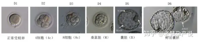 成都哪里可以做供卵试管婴儿（试管婴儿成功率高的医生，这样评估胚胎等级）