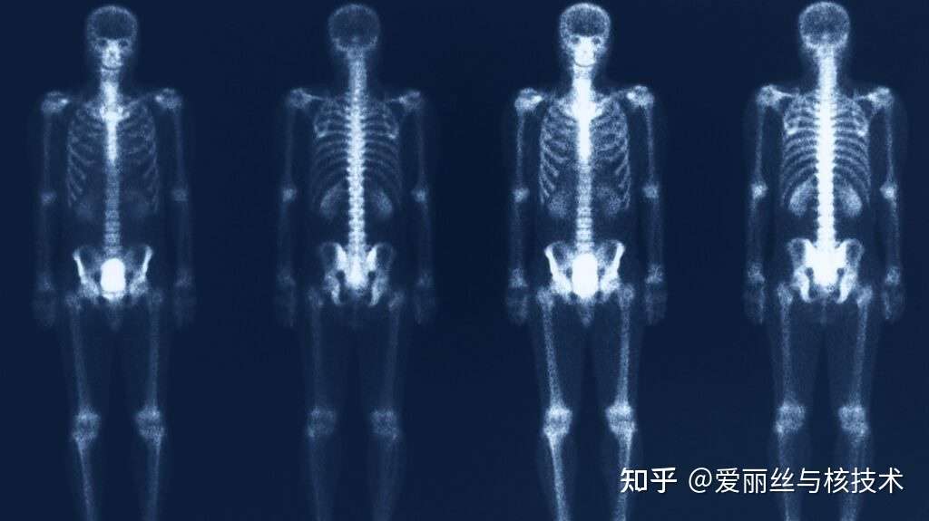 什么是核骨扫描 有什么用 需要注意什么 知乎 什么是核骨扫描 有什么用 需要注意什么 知乎